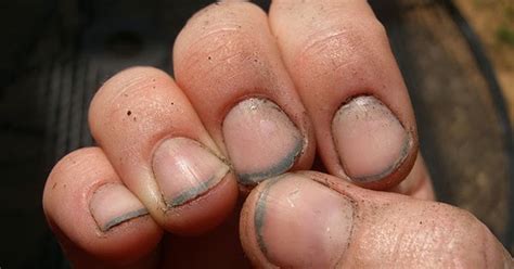 Dirty Fingernails