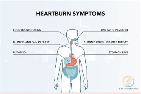 Always Suffering From Heartburn Or Acid Reflux You May Have A