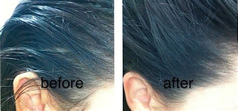 Jan 30, 2020 · how to make your hair less greasy here's the gist of scalp training: BeautyEnigma: REVIEW: DOVE Dry Shampoo
