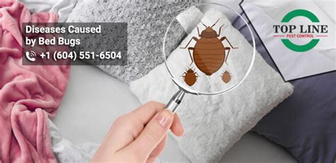 Diseases Caused By Bed Bugs Top Line Pest Control