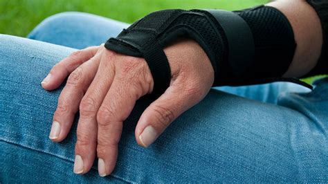 Rheumatoid Arthritis Treatment With Splints And Braces