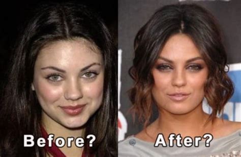 Celeb Surgery Mila Kunis Plastic Surgery Before And After Celeb
