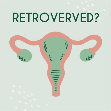 Retroverted Uterus Find Out How To Position Femieko
