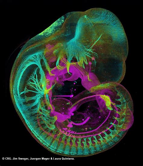Mouse Embryo With Neurofilament And E Cadherin Staining Crg Tech Transfer