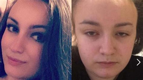 British Teen Bravely Posts Contrasting Selfies With An