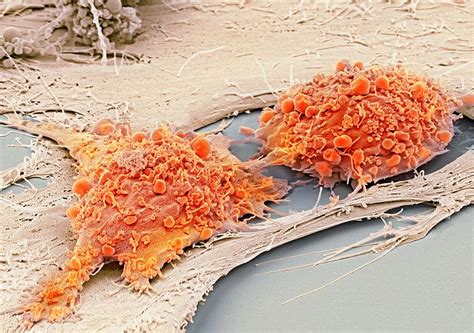 Mesenchymal Stem Cells Sem Photograph By Science Photo Library Fine