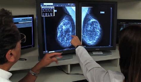 El Hospital De Valme Consolida La Aplicación De La Mamografía Digital