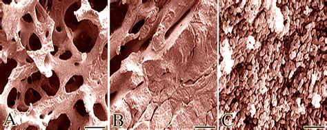 Sem Ultramicrographs Of Microstructure Of Natural Bone Grafts A