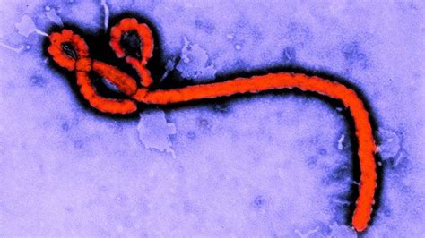 Ebola Treatment