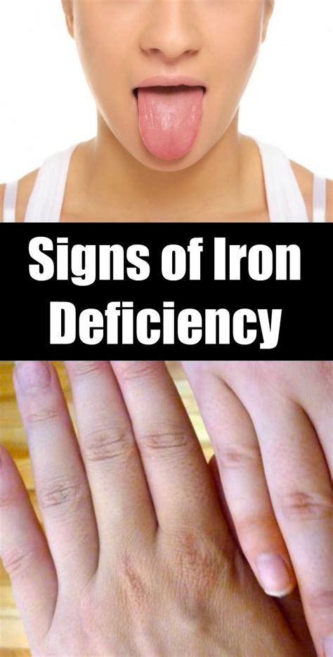 Signs Of Iron Deficiency When Should You Panic Signs Of Iron