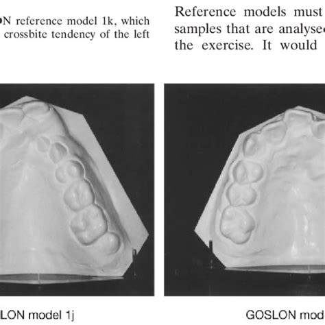 Occlusal Views Of Upper Arches Goslon Reference Models 1j And 1k Download Scientific Diagram