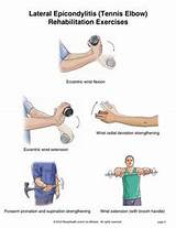 Pictures of Exercises For Tennis Elbow