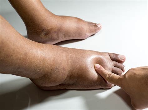 Diabetic Foot Pain Here S What To Know Canyon Oaks Foot And Ankle