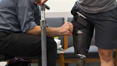 Infinite Socket Device Offers Amputees Customized Comfortable