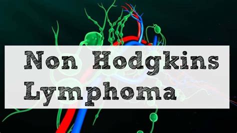 Non Hodgkins Lymphoma Dr John Bergman
