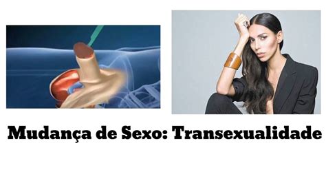 Mudança de Sexo Transexualidade Cirurgia e diagnóstico do TRANSEX