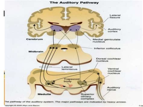 Auditory pathway