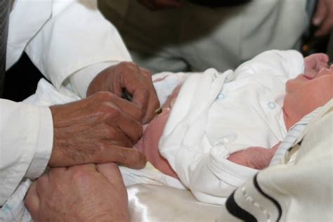 Preemptive Male Circumcision Debate No Compelling Scientific Arguments
