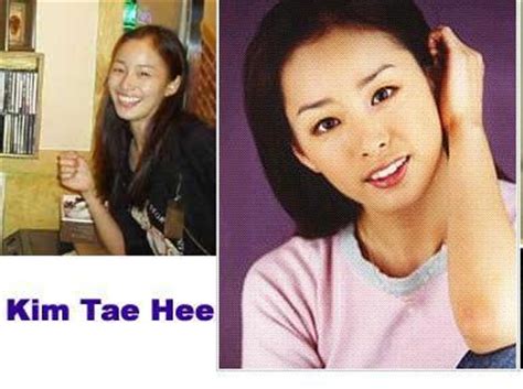 Kim tae hee plastic surgery before and after. Crunchyroll - Forum - Korean plastic surgery - Page 15
