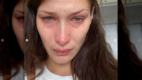 bella hadid opens up about her mental health struggles