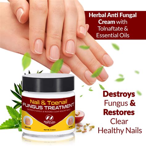 Nail And Toenail Fungus Treatment Herbal Anti Fungal Cream
