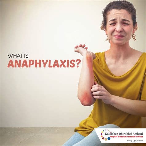 What Is Anaphylaxis Health Tips From Kokilaben Hospital