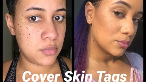 How To Cover Moles And Freckles With Makeup Mugeek Vidalondon