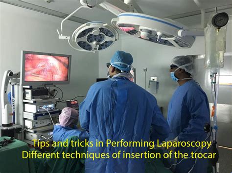 Tips And Tricks In Performing Laparoscopy Different Techniques Of