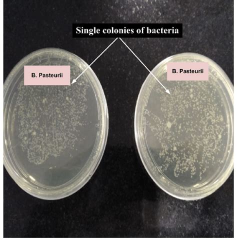 Single Bacteria Colonies On Agar Plate Download Scientific Diagram