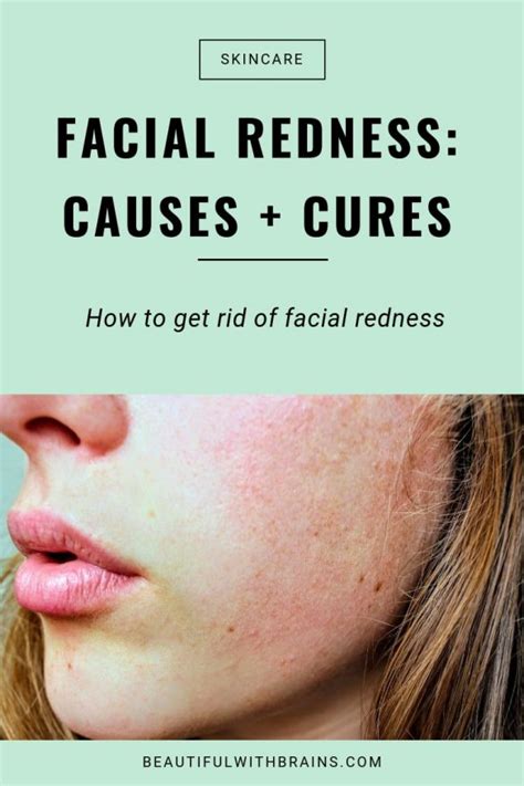 Facial Redness Causes And Cures Beautiful With Brains
