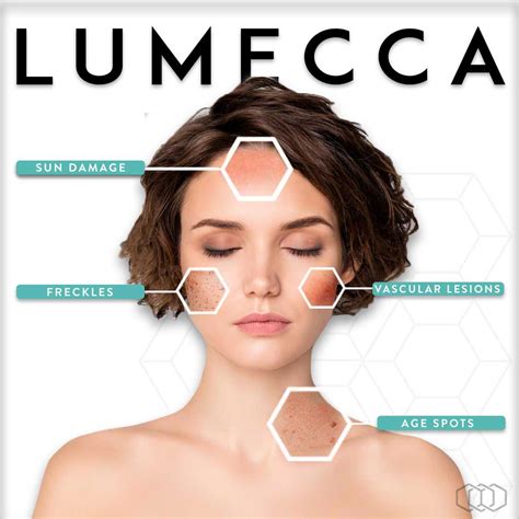 Lumecca Ipl Photofacial And Skin Rejuvenation Restorations Medical Spa