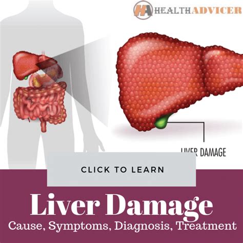 Signs Of Liver Damage Causes Picture Symptoms Treatment