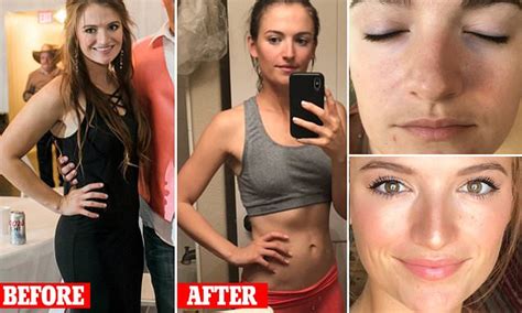 Woman Loses 20lbs On The Raw Vegan Diet Daily Mail Online