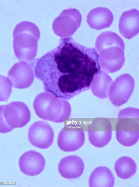 White Blood Cell Or Leukocyte Monocyte Human Blood Smear 400x Stockfoto