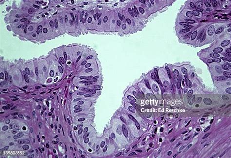 Ciliated Epithelial Photos And Premium High Res Pictures Getty Images