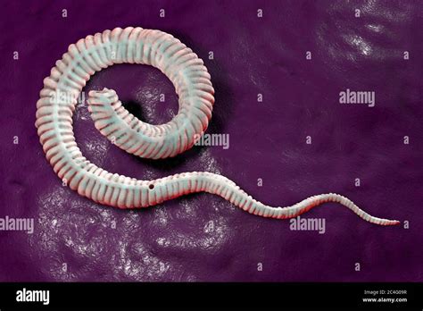 Guinea Worm Dracunculus Medinensis First Stage Larva Computer