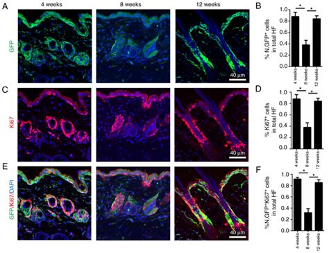 Dynamic Nestin Expression During Hair Follicle Maturation And The