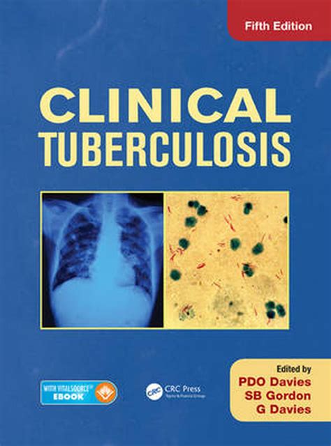 Clinical Tuberculosis Fifth Edition By Pp English Hardcover Book