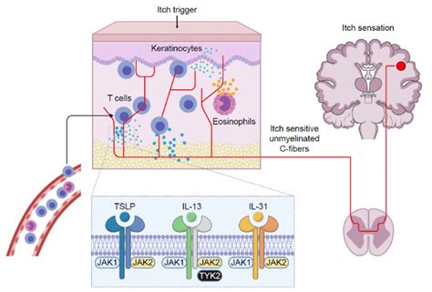 Jak Dependent Signaling Significantly Contributes To Chronic Itch Il