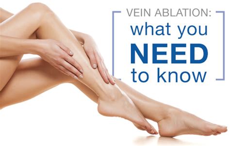 Sclerotherapy Venous Ablation Landa Medspa Is A Professional