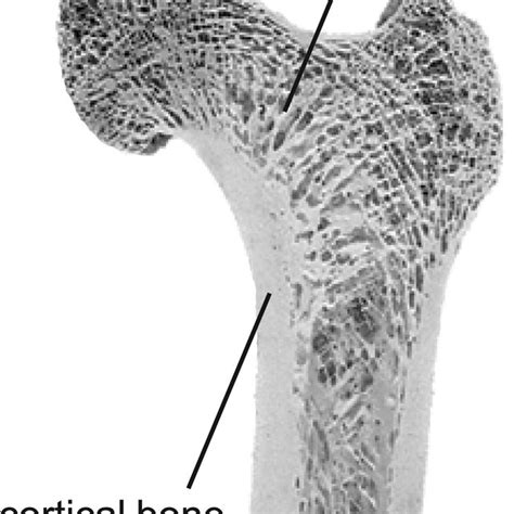 Cortical And Cancellous Bone In Human Femur Download Scientific Diagram