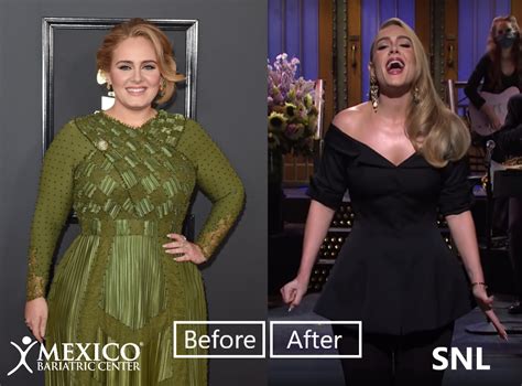 Adele Weight Loss 2020 Did She Have Bariatric Surgery 2022