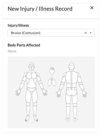Here presented 65+ human body parts drawing images for free to download, print or share. Incidents: Body Diagram Added to 'Body Parts Affected ...