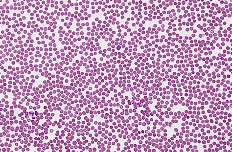 Blood Smear Light Micrograph Stock Image C0543014 Science Photo
