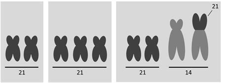 Wat Is Downsyndroom Stichting Dementietafel Groningen