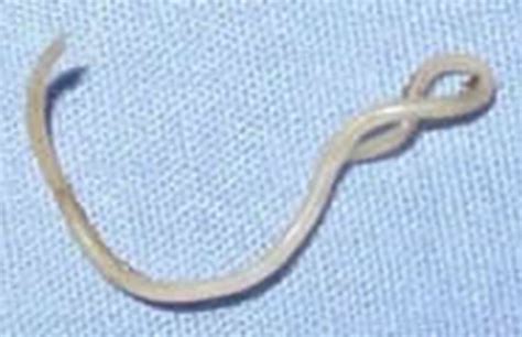 Roundworms In Cats