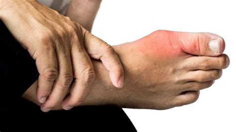 What Are The Main Causes Of Psoriatic Arthritis Psoriatic Psoriatic