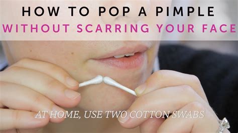 Báró Kiterjed Gumi How To Pop Pimple Correctky Aktiválás Finomkodik