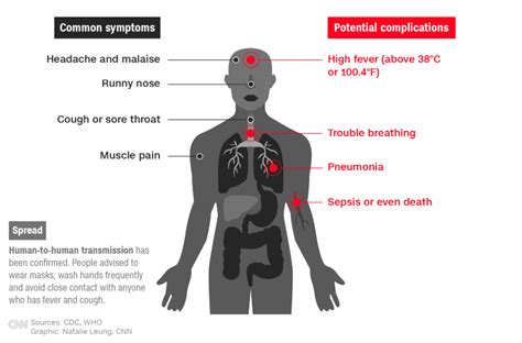 What Are The Symptoms Of Coronavirus