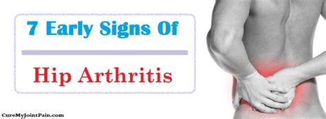 7 Most Common Early Signs Of Hip Arthritis Cure My Joint Pain